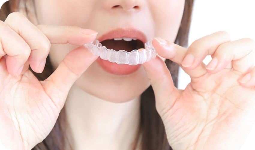 マウスピースをつける写真