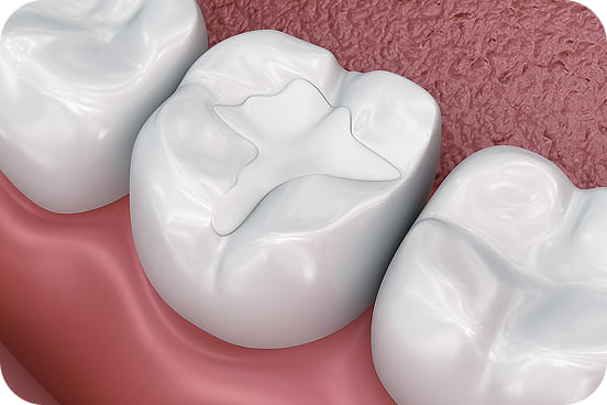 セラミックのイラスト