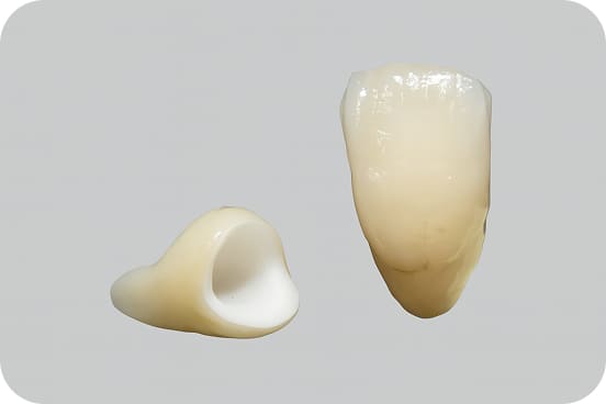 ジルコニアのイラスト