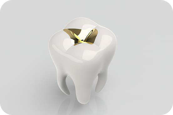 ゴールドのイラスト