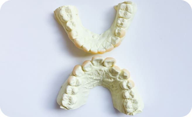 型取り・かみ合わせの器具