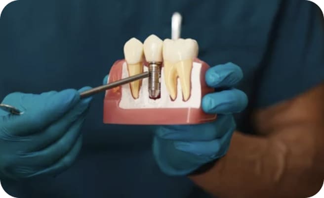 歯のイラストを示している様子