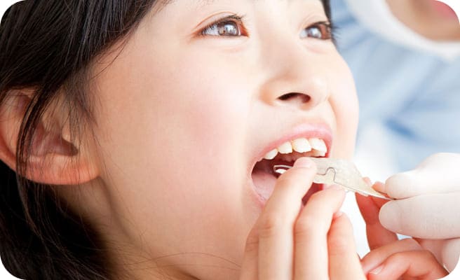 レントゲンの写真