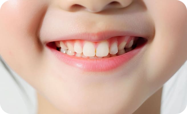 レントゲンの写真