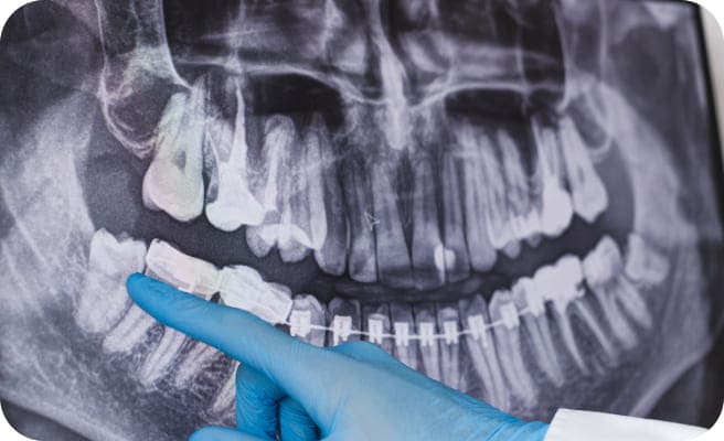 歯のレントゲンを見ている様子