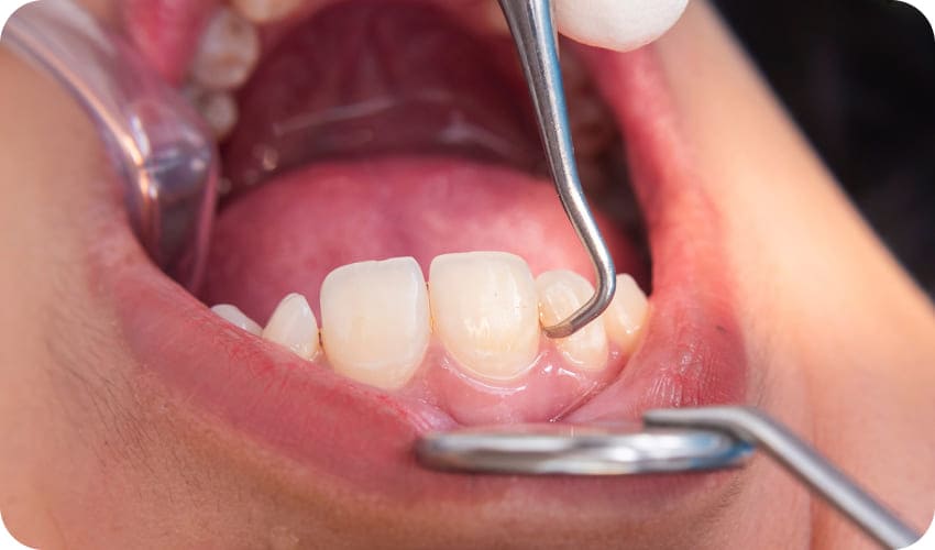 歯の検査中の様子